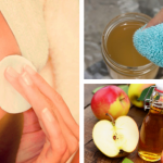 Beneficios de usar vinagre de manzana para lavar el rostro