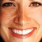 10 maneras eficaces de reducir los poros y espinillas de la cara