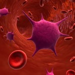 Los coágulos sanguíneos pueden ser fatales: síntomas y signos – 2