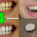 Receta casera para blanquear los dientes en menos de 2 minutos!