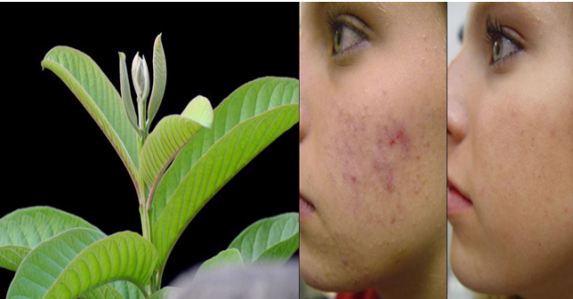 Usando estas hojas podrás vencer las arrugas, acne, manchas oscuras y alergias de la piel en menos de 3 días!