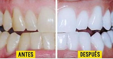 Tus dientes quedarán blancos como la nieve, Usando tan sólo 3 ingredientes que hallarás en casa