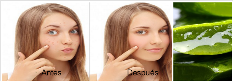 En una semana eliminarás los puntos negros y manchas de tu rostro con este ingrediente