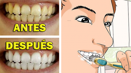 La placa dental se elimina y se blanquean los dientes en 4 minutos con este remedio natural