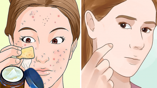 Elimina las manchas e imperfecciones de tu rostro con esta crema casera