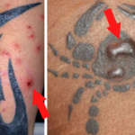 Estos son los riesgos de los Tatuajes para la Salud